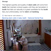 Epsteins Dental Chair and Stem Cell Extraction From Children?