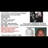 KIDNAPPING MADELINE MCCANN: SUSPECT 2b FOUND!